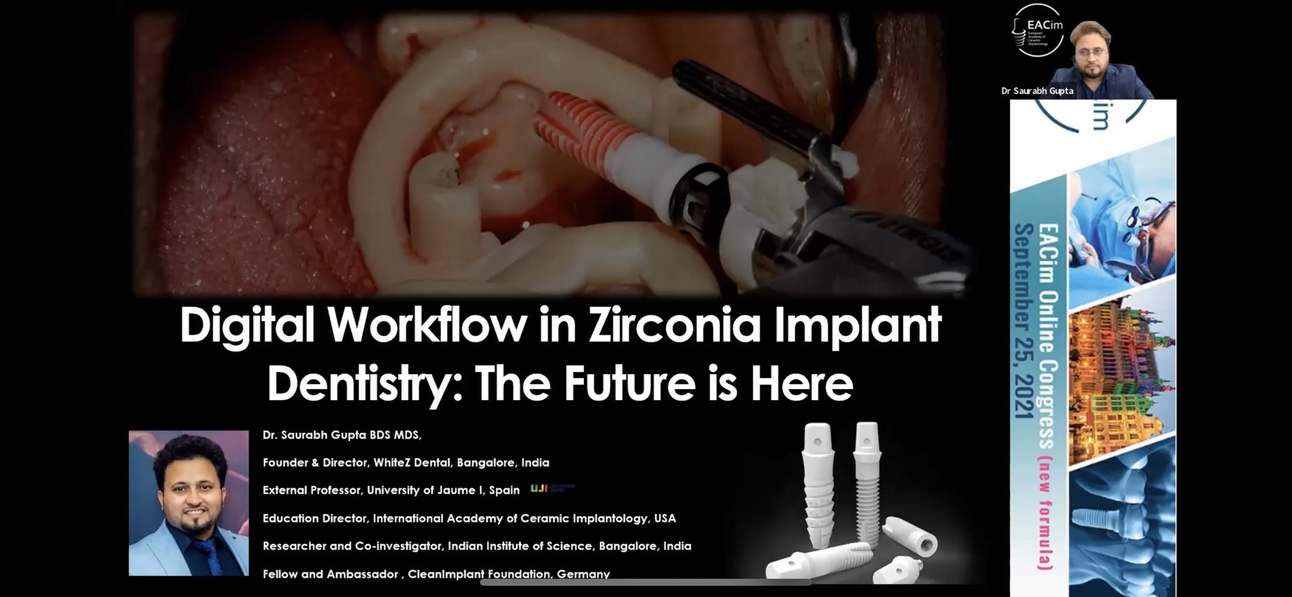 Digital Workflow in Zirconia Implant Dentistr：The future is Here
