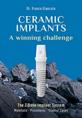 Ceramic Implants  A winning challenge [Print Replica] Kindle Edition